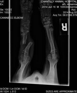 x-ray of McKenna's broken leg